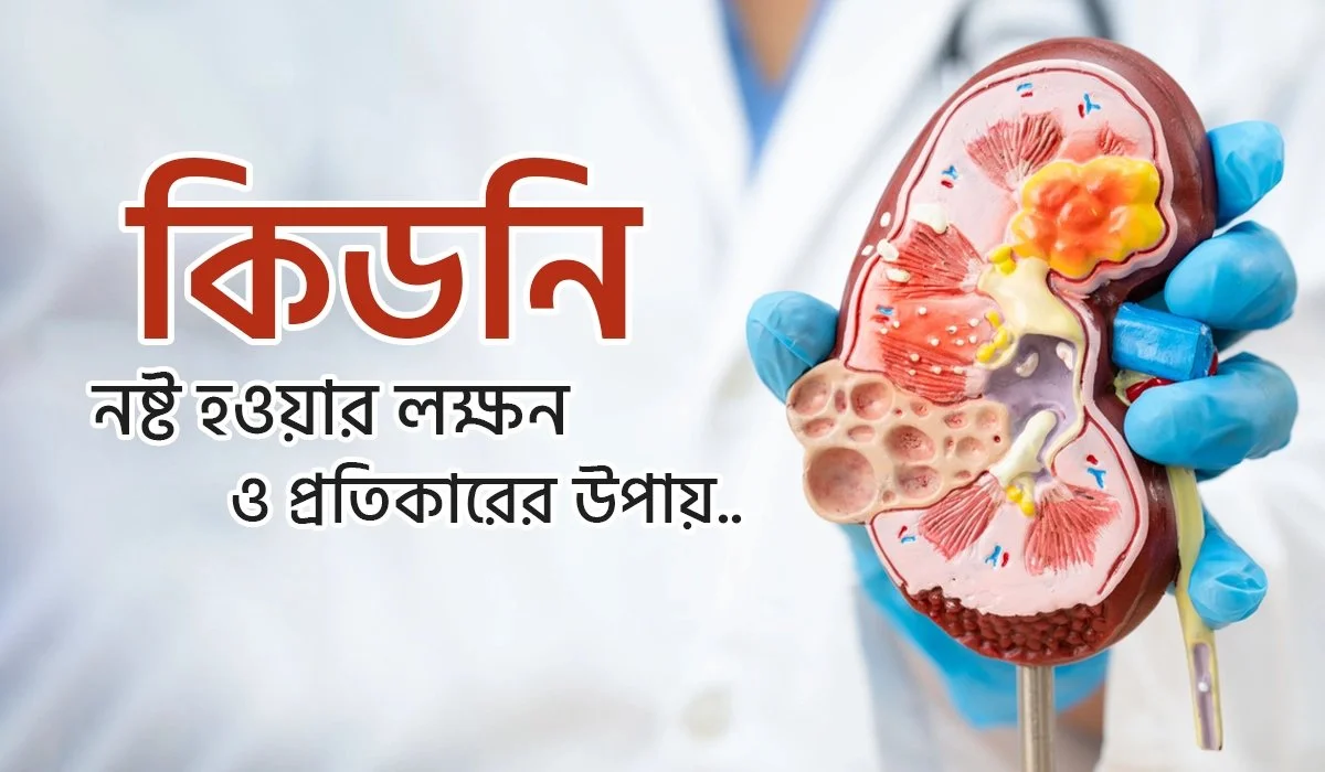 কিডনি নষ্ট হওয়ার লক্ষণ ও কিডনি সুস্থ রাখার প্রাকৃতিক খাদ্যাভাস