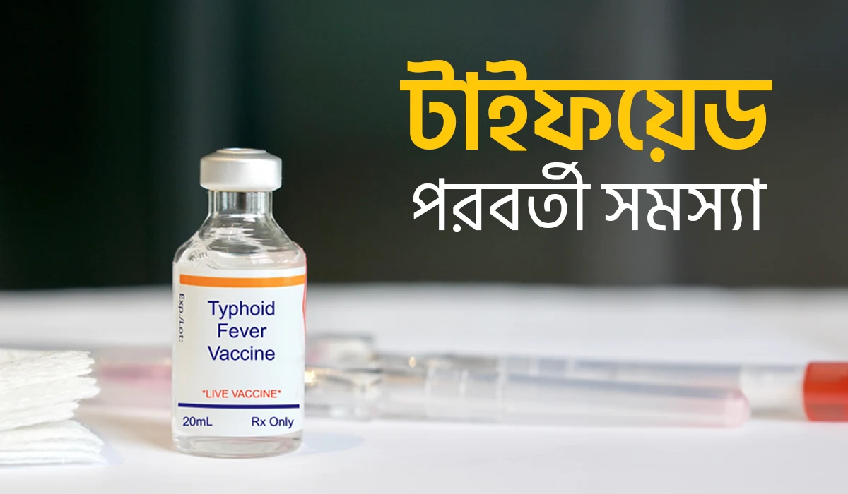 টাইফয়েড পরবর্তী সমস্যা, জেনে নিন প্রতিরোধের উপায়