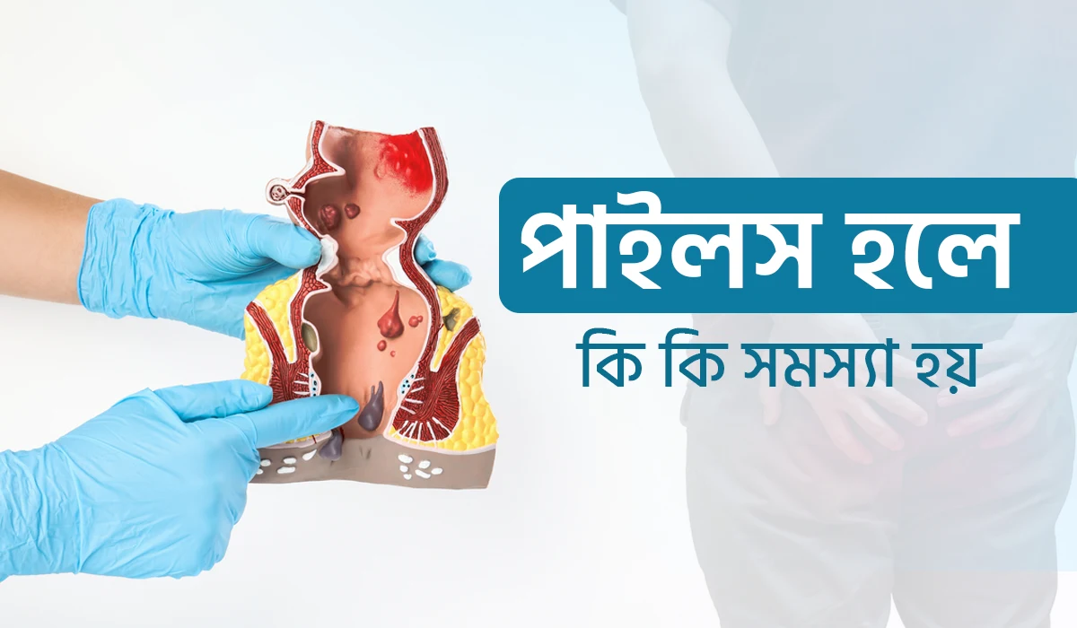 পাইলস হলে কি কি সমস্যা হয়