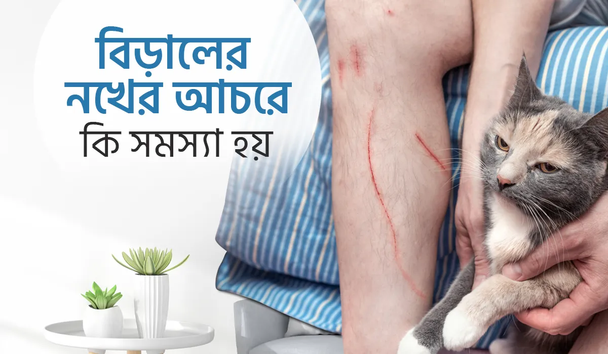 বিড়ালের নখের আঁচড়ে কি কি সমস্যা হয়?